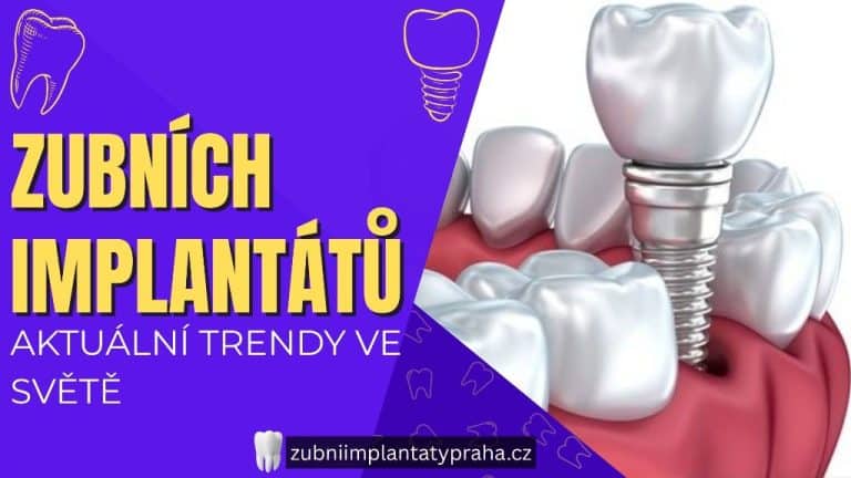 Aktuální trendy ve světě zubních implantátů