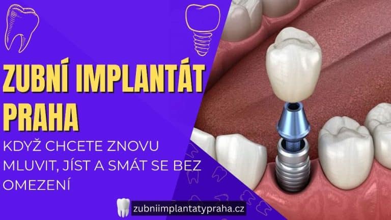 Zubní implantát Praha_ Když chcete znovu mluvit, jíst a smát se bez omezení
