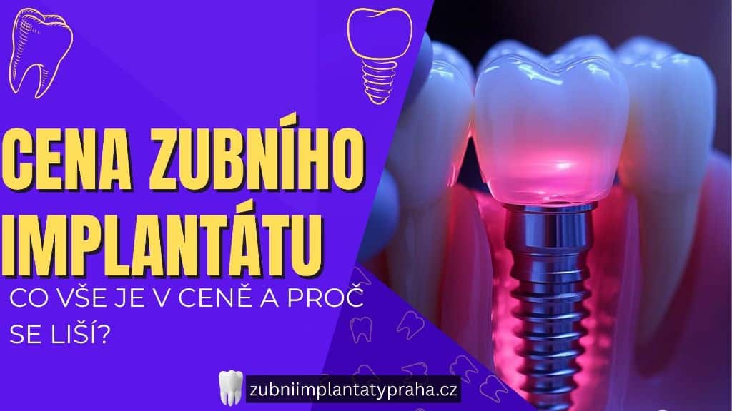 Cena zubního implantátu_ Co vše je v ceně a proč se liší