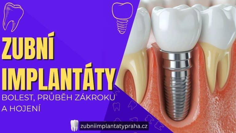 Zubní implantáty – bolest, průběh zákroku a hojení