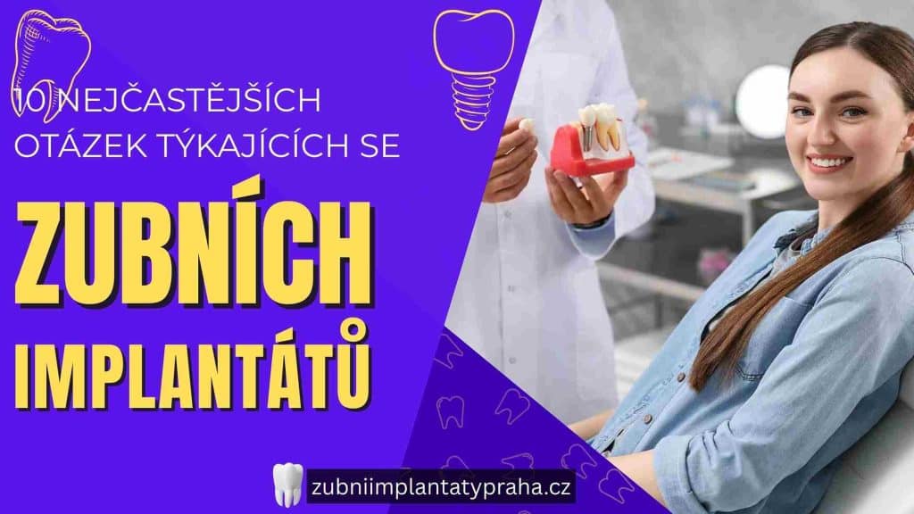 10 nejčastějších otázek týkajících se zubních implantátů