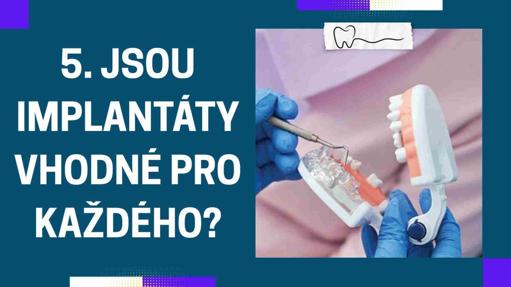 Jsou implantáty vhodné pro každého