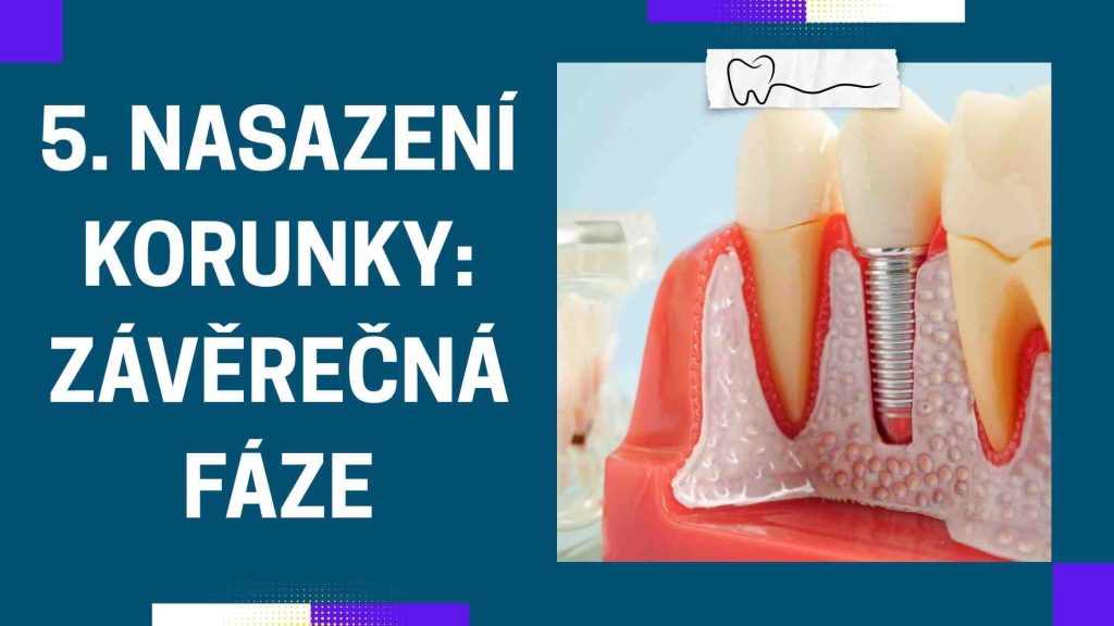 Nasazení korunky_ závěrečná fáze