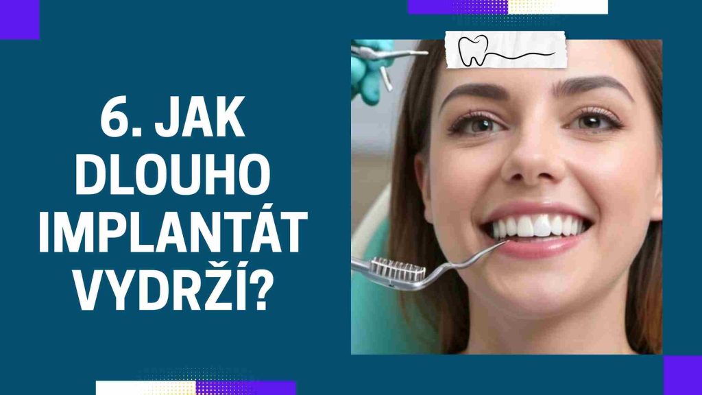 Jak dlouho implantát vydrží