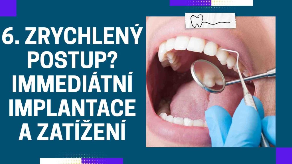 Zrychlený postup_ Immediátní implantace a zatíženíZrychlený postup_ Immediátní implantace a zatížení