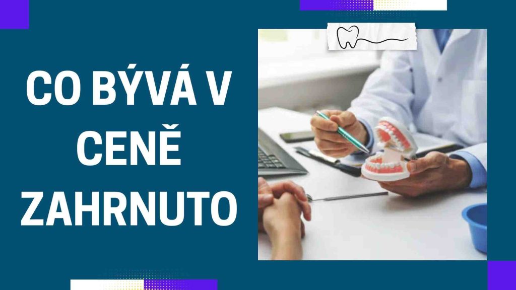 Co bývá v ceně zahrnuto
