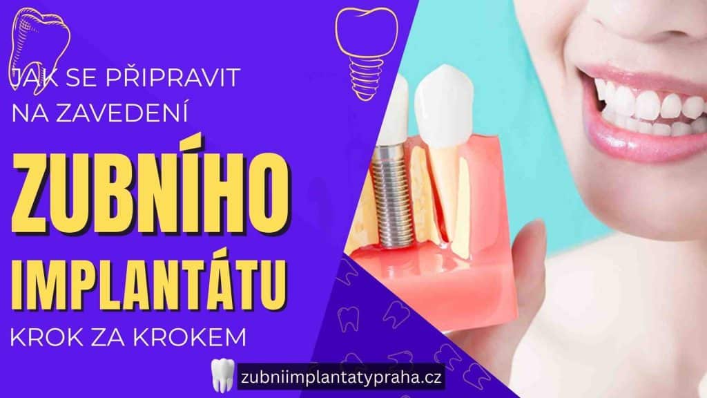 Jak se připravit na zavedení zubního implantátu krok za krokem