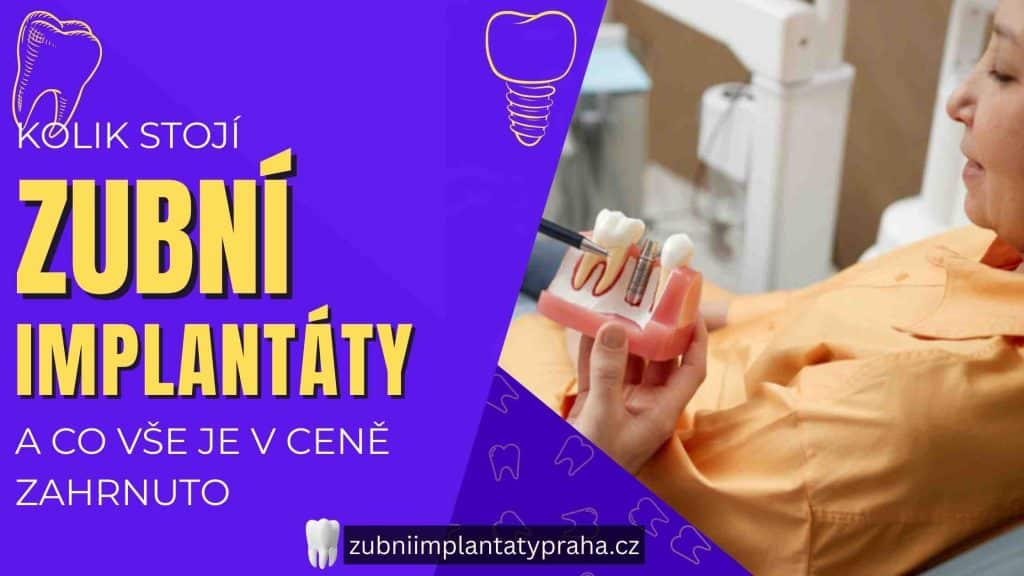 Kolik stojí zubní implantáty a co vše je v ceně zahrnuto