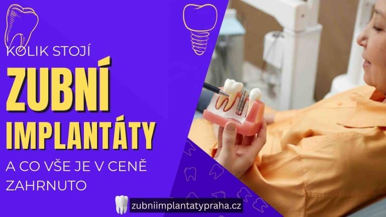 Kolik stojí zubní implantáty a co vše je v ceně zahrnuto