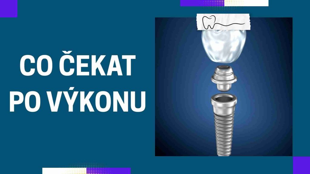 Co čekat po výkonu
