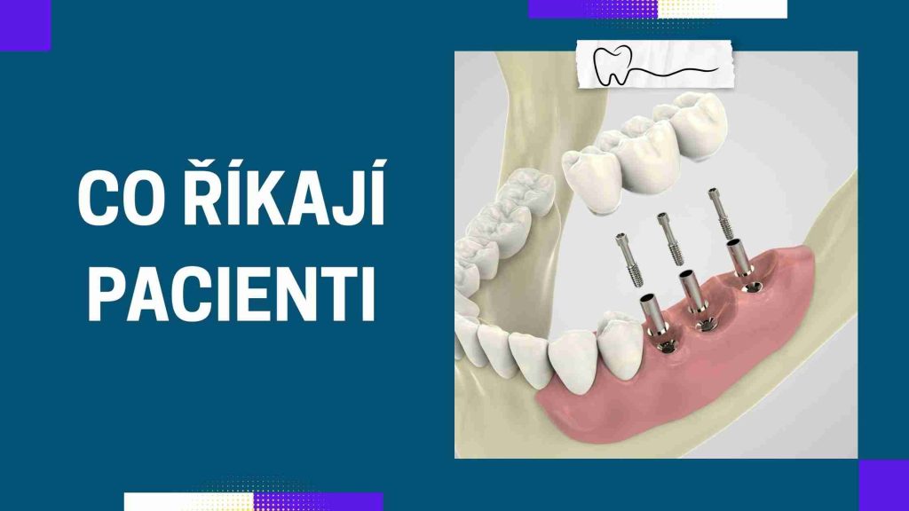 Co říkají pacienti