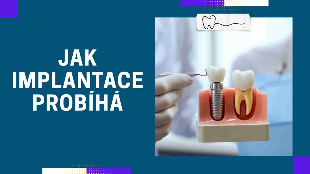 Jak implantace probíhá